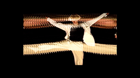 SLIT SCAN